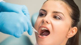 Toronto-dentist-service-implants
